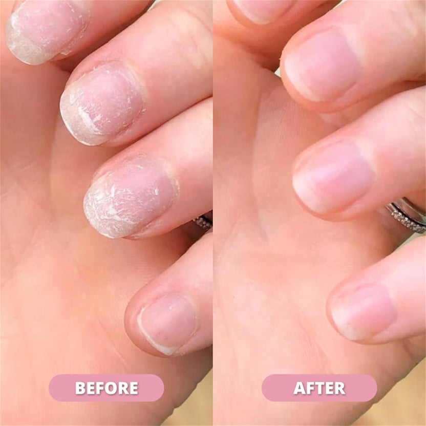 Nail Growth & Cuticle Oil Pen – Radiant Serum Nutrient Pen for Moisturizing