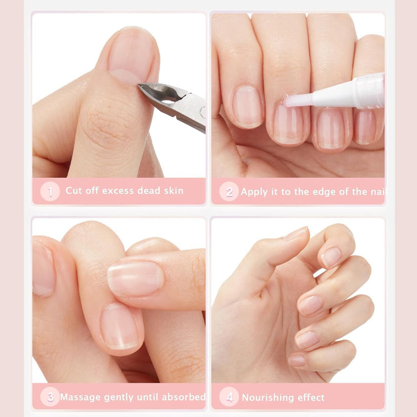 Nail Growth & Cuticle Oil Pen – Radiant Serum Nutrient Pen for Moisturizing